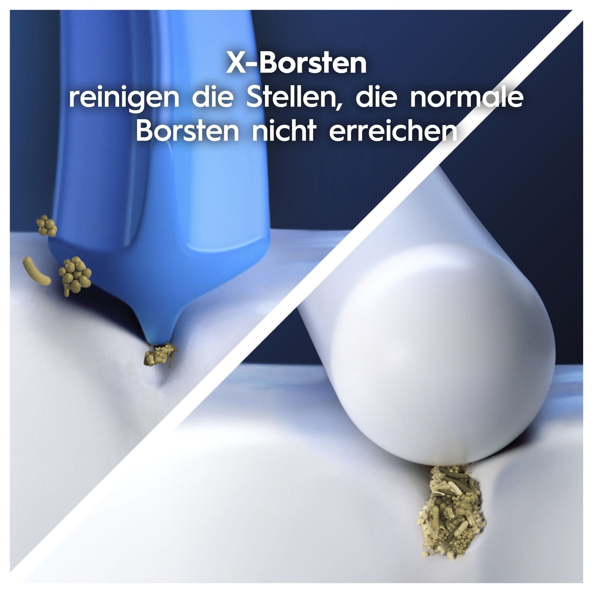10 brossettes Sensitive Clean — soies extra-douces pour des mois de stock